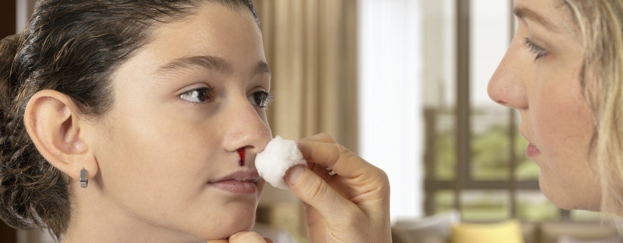 is-it-normal-for-children-to-have-nosebleeds-and-what-are-the-causes